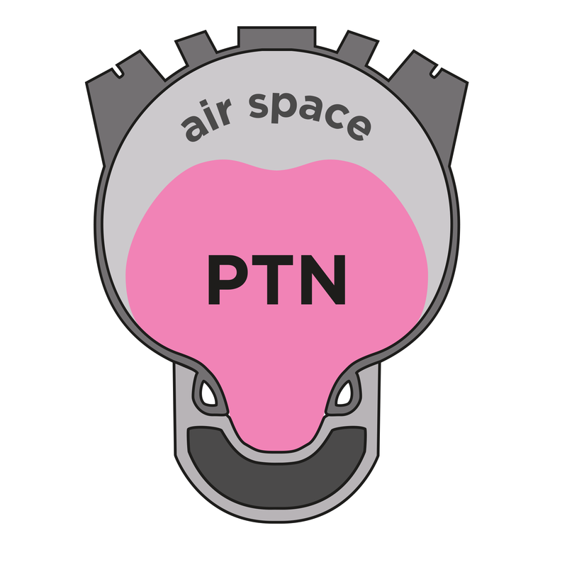 Pepi's PTN R-Evolution rengasinsertti 2